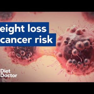 Weight loss reduces cancer risk
